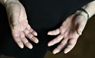 Hænder med håndeksem